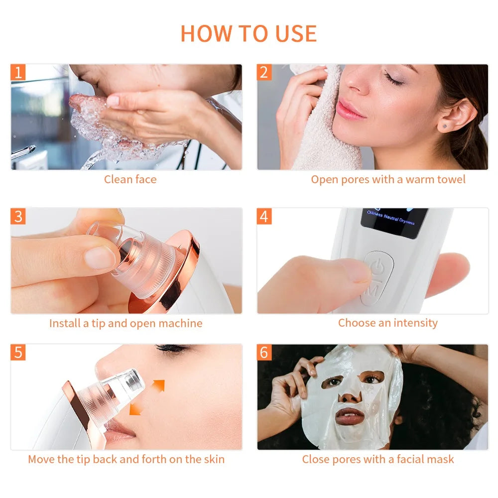 Vacuum Nose Blackhead Remover